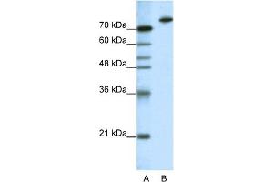 WB Suggested Anti-KLHL3 Antibody Titration:  1. (KLHL3 Antikörper  (N-Term))