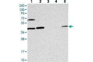 Western blot analysis of Lane 1: RT-4, Lane 2: U-251 MG, Lane 3: Human Plasma, Lane 4: Liver, Lane 5: Tonsil with COPS4 polyclonal antibody  at 1:250-1:500 dilution.