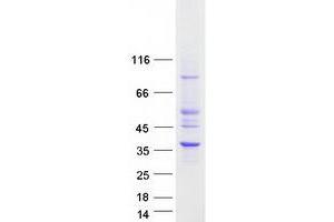 Western Blotting (WB) image for Hydroxysteroid (17-Beta) Dehydrogenase 11 (HSD17B11) protein (Myc-DYKDDDDK Tag) (ABIN2714227)