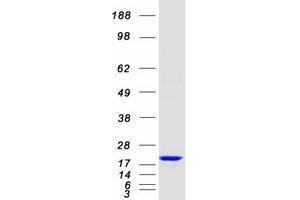Western Blotting (WB) image for Myosin Light Chain, phosphorylatable, Fast Skeletal Muscle (MYLPF) protein (Myc-DYKDDDDK Tag) (ABIN2726685)