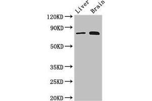 Western Blot Positive WB detected in: Mouse liver tissue, Mouse brain tissue All lanes: TBK1 antibody at 3 μg/mL Secondary Goat polyclonal to rabbit IgG at 1/50000 dilution Predicted band size: 84 kDa Observed band size: 84 kDa (TBK1 Antikörper  (AA 364-585))