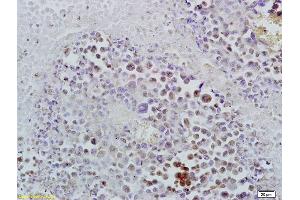 Formalin-fixed and paraffin embedded rat brain tissue labeled with Anti-ID1 Polyclonal Antibody, Unconjugated (ABIN700330) at 1:200 followed by conjugation to the secondary antibody and DAB staining (ID1 Antikörper  (AA 51-155))