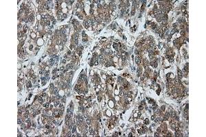 Image no. 4 for anti-Bruton Agammaglobulinemia tyrosine Kinase (BTK) antibody (ABIN1496976) (BTK Antikörper)