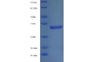 SDS-PAGE (SDS) image for Trimethylguanosine Synthase 1 (TGS1) (AA 713-853), (partial) protein (His-SUMO Tag) (ABIN5711660)