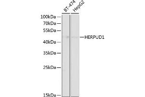 Western blot analysis of extracts of various cell lines, using HERPUD1 antibody (ABIN6130838, ABIN6141721, ABIN6141723 and ABIN6218339) at 1:1000 dilution. (HERPUD1 Antikörper  (AA 1-240))