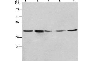 Western Blot analysis of A549, NIH/3T3 and 293T cell,Human hepatocellular carcinoma tissue and hela cell using RPSA Polyclonal Antibody at dilution of 1:425 (RPSA/Laminin Receptor Antikörper)
