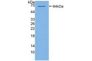 Detection of Recombinant PI4Ka, Human using Polyclonal Antibody to Phosphatidylinositol-4-Kinase Catalytic Alpha (PI4Ka)
