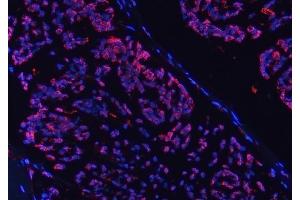 IF analysis of COX5B using anti-COX5B antibody (ABIN7598975). (COX5B Antikörper  (AA 1-129))