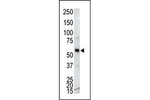 Western blot analysis of anti-CK 1G Pab (ABIN391376 and ABIN2841387) in NCI- cell lysate. (CAMK1G Antikörper  (C-Term))