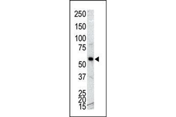 CAMK1G Antikörper  (C-Term)