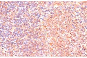 Immunohistochemistry of paraffin-embedded Rat spleen using IL4R Polyclonal Antibody at dilution of 1:100 (40x lens). (IL4 Receptor Antikörper)