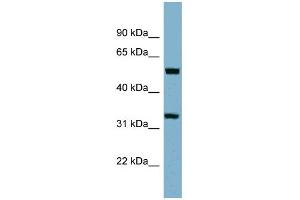 WB Suggested Anti-TMEM158 Antibody Titration:  0. (TMEM158 Antikörper  (Middle Region))