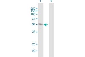 Western Blotting (WB) image for anti-Homocysteine-Inducible, Endoplasmic Reticulum Stress-Inducible, Ubiquitin-Like Domain Member 1 (HERPUD1) (AA 1-391) antibody (ABIN523183)