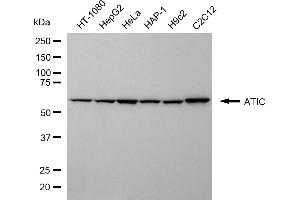 Western blotting analysis using ATIC antibody (ABIN7797424). (ATIC Antikörper)