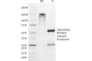 SDS-PAGE Analysis of Purified, BSA-Free Melan-A Antibody (clone M2-9E3).