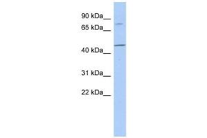 FBXO39 antibody used at 1 ug/ml to detect target protein. (FBXO39 Antikörper  (N-Term))