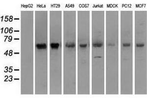 Western blot analysis of extracts (35 µg) from 9 different cell lines by using anti-SILV monoclonal antibody. (Melanoma gp100 Antikörper)