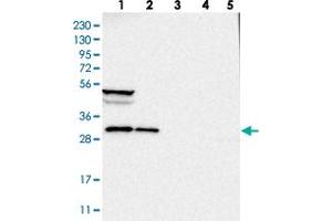 Western blot analysis of Lane 1: RT-4, Lane 2: U-251 MG, Lane 3: Human Plasma, Lane 4: Liver, Lane 5: Tonsil with SBDS polyclonal antibody  at 1:250-1:500 dilution. (SBDS Antikörper)
