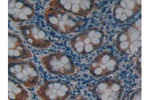 Figure. (MMP12 Antikörper  (AA 290-469))