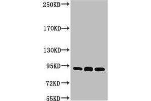 Western blot analysis of 1) Hela, 2) Mouse Brain tissue, 3) Rat Brain tissue, diluted at 1:2000. (HSP9AB1 Antikörper)