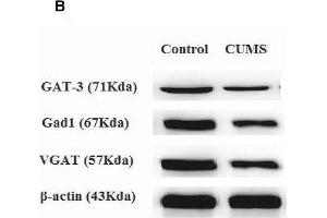 Chronic unpredictable mild stress (CUMS) exposures decrease GABAergic neuron-associated gene/protein expression level in the NAc tissue. (beta Actin Antikörper)