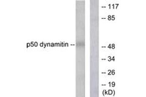 Western blot analysis of extracts from A549 cells, using p50 Dynamitin Antibody.