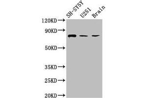 Western Blot Positive WB detected in: SH-SY5Y whole cell lysate, U251 whole cell lysate, Rat brain tissue All lanes: NCDN antibody at 2. (NCDN Antikörper  (AA 403-516))
