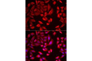 Immunofluorescence analysis of HeLa cells using CCT2 antibody (ABIN5973929). (CCT2 Antikörper)