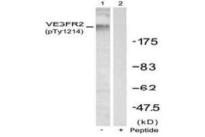 Image no. 2 for anti-VEGF Receptor 2 (VEGFR2) (pTyr1214) antibody (ABIN196768) (VEGFR2/CD309 Antikörper  (pTyr1214))