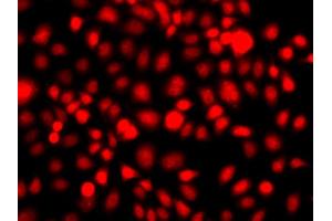 Immunofluorescence analysis of A549 cells using NR2E1 antibody (ABIN6290680).