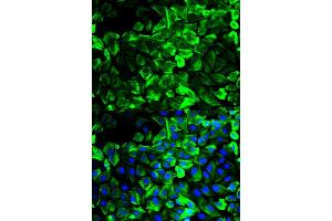 Immunofluorescence analysis of HeLa cell using TPM1 antibody. (Tropomyosin Antikörper)