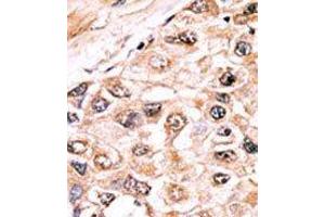 Immunohistochemistry (Paraffin-embedded Sections) (IHC (p)) image for anti-Activin Receptor Type I (ACRV1) (Middle Region) antibody (ABIN359222)