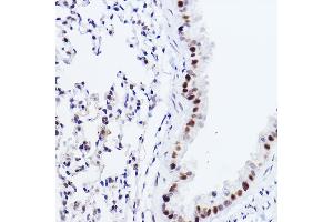 Immunohistochemistry of paraffin-embedded mouse lung using p73 Rabbit mAb (ABIN1678945, ABIN1678944, ABIN7101487 and ABIN7101488) at dilution of 1:100 (40x lens). (Tumor Protein p73 Antikörper)