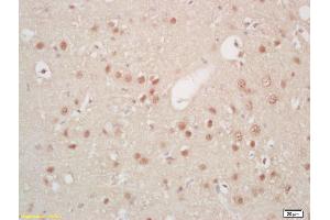 Formalin-fixed and paraffin embedded rat brain labeled with Rabbit Anti Hes5 Polyclonal Antibody, Unconjugated (ABIN703811) at 1:200 followed by conjugation to the secondary antibody and DAB staining (HES5 Antikörper  (AA 21-120))