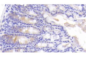 Detection of ICK in Mouse Colon Tissue using Polyclonal Antibody to Intestinal Cell Kinase (ICK) (ICK Antikörper  (AA 1-284))