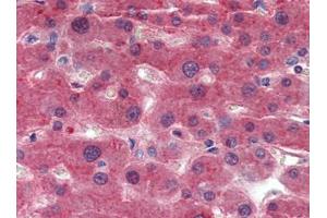 Immunohistochemistry (Paraffin-embedded Sections) (IHC (p)) image for anti-Transthyretin (TTR) antibody (ABIN615282)