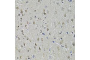 Immunohistochemistry of paraffin-embedded mouse brain using DDX1 Antibody (ABIN5973950) at dilution of 1/100 (40x lens). (DDX1 Antikörper)