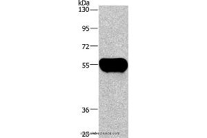 Western blot analysis of Human plasma tissue, using AHSG Polyclonal Antibody at dilution of 1:1350 (Fetuin A Antikörper)