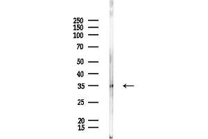 anti-BCL2/adenovirus E1B 19kDa Interacting Protein 3-Like (BNIP3L) (Internal Region) antibody