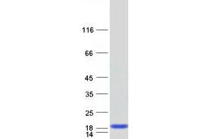 Western Blotting (WB) image for Fatty Acid Binding Protein 6, Ileal (FABP6) (Transcript Variant 2) protein (Myc-DYKDDDDK Tag) (ABIN2720670)