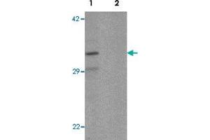 Western blot analysis of K562 cell lysate with CLEC2A polyclonal antibody  at 1 ug/mL in (1) the absence and (2) the presence of blocking peptide. (CLEC2A Antikörper  (N-Term))