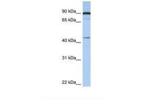 Image no. 1 for anti-Proteasome (Prosome, Macropain) 26S Subunit, Non-ATPase, 6 (PSMD6) (N-Term) antibody (ABIN6737678)