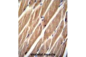 Immunohistochemistry (IHC) image for anti-Phosphatidylinositol-4-Phosphate 5-Kinase-Like 1 (PIP5KL1) antibody (ABIN2996126) (PIP5KL1 Antikörper)