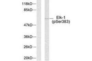 Western blot analysis of extracts from HeLa cells treated with UV, using Elk1 (Phospho-Ser383) Antibody. (ELK1 Antikörper  (AA 351-400))