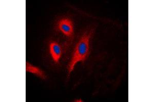 Immunofluorescent analysis of FADD staining in HeLa cells. (FADD Antikörper  (Center))
