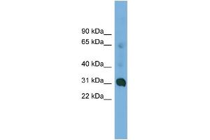 WB Suggested Anti-CCDC127 Antibody Titration: 0. (CCDC127 Antikörper  (N-Term))