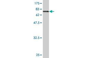 Western Blot detection against Immunogen (73. (ENO1 Antikörper  (AA 1-434))