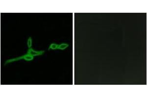 Immunofluorescence analysis of LOVO cells, using GPR15 Antibody. (GPR15 Antikörper  (AA 201-250))
