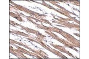 Immunohistochemistry of MAK10 in human heart tissue with this product at 2. (MAK10/NAA35 Antikörper  (N-Term))