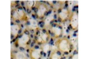IHC-P analysis of Kidney tissue, with DAB staining. (Decorin Antikörper  (AA 45-152))